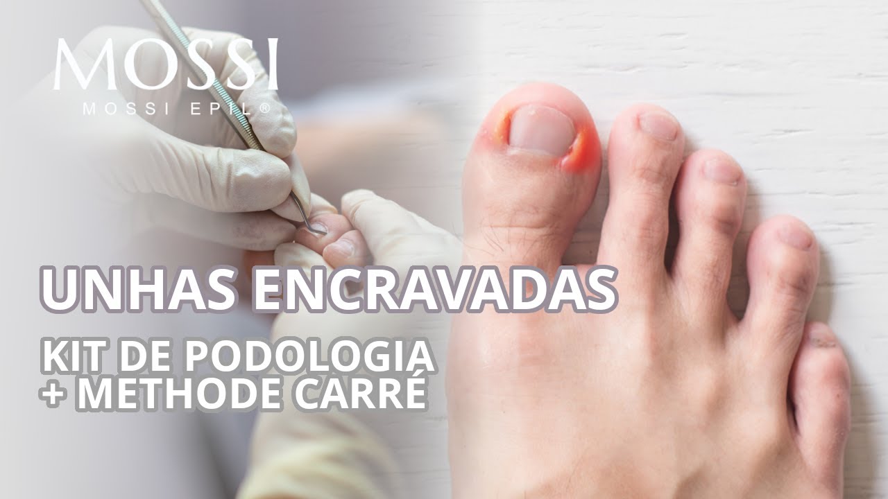 Mossi Epil Academia: Kit de Podologia & Método de Carré, por Francisco Martins #unhaencravada #unhas