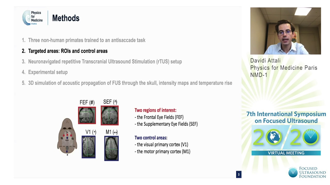 D. Attali - Manipulations of Oculomotor Performance in Non-Human Primates by Transcranial US (2020)