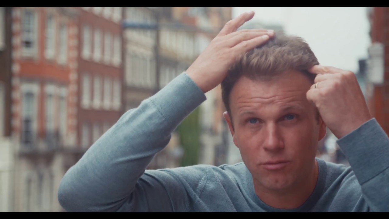Hair transplant - SPEX'S procedure