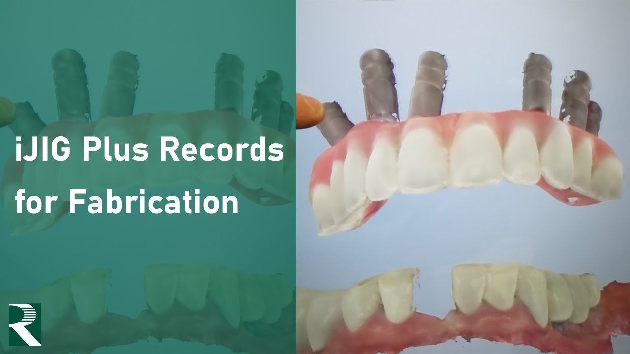 iJIG Plus Records for Fabrication