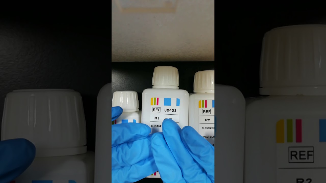 طريقة إجراء تحليل البليروبين total bilirubin and direct bilirubin test