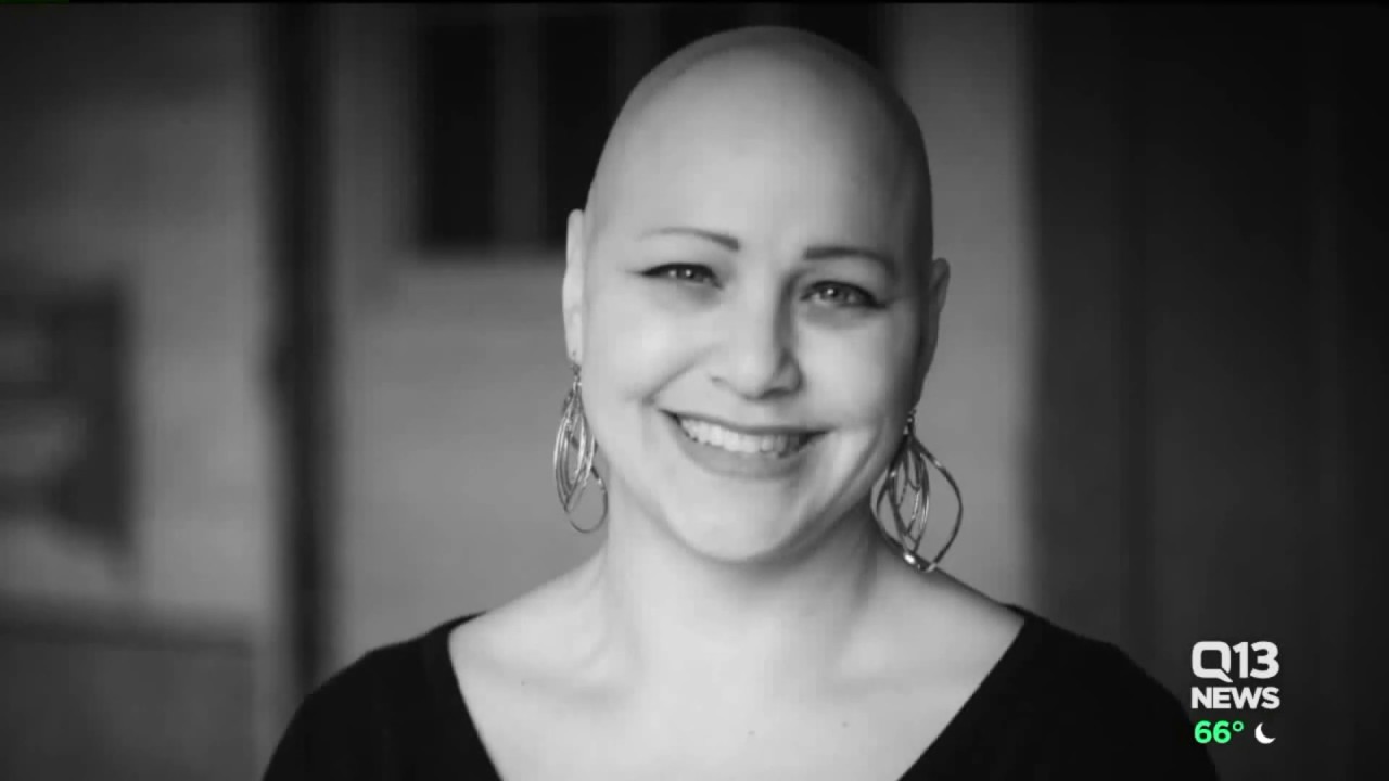Deeann Graham speaks about living with Alopecia Areata