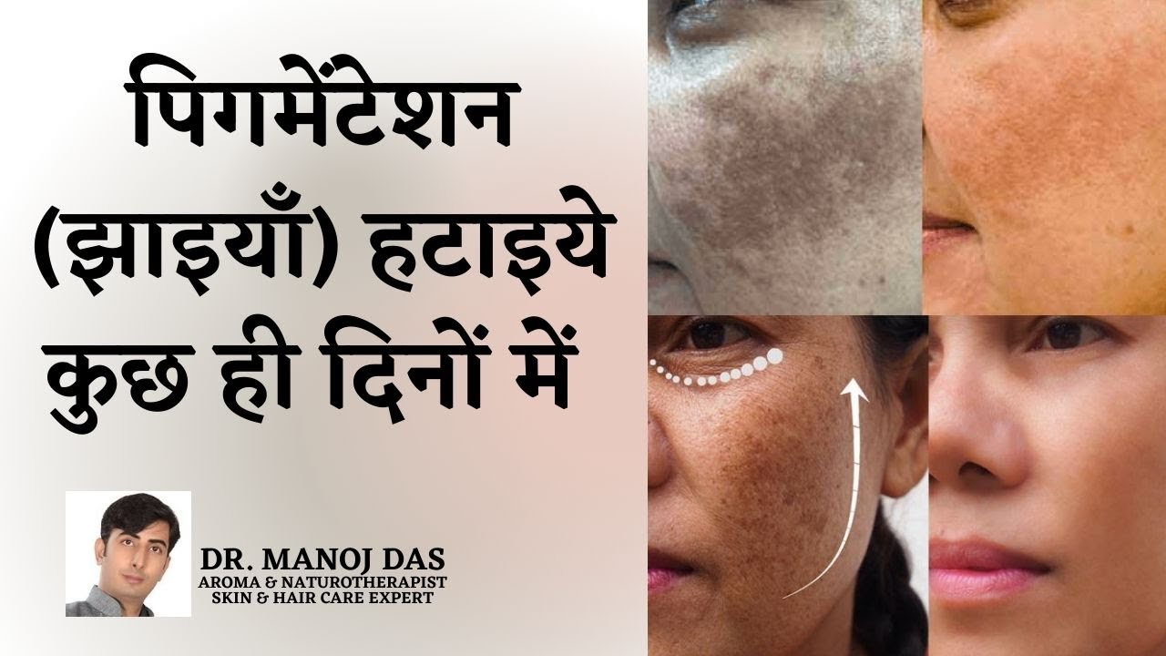 How to remove pigmentation I Remove Dark Spots I Pigmentation I Dr.manoj das