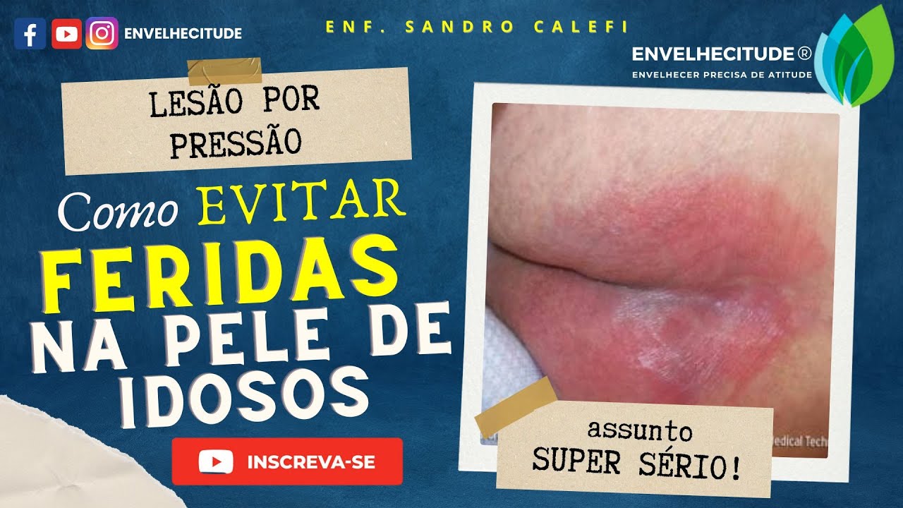PREVENÇÃO DE LESÕES EM IDOSOS ACAMADOS: CONHEÇA AS MELHORES PRÁTICAS!