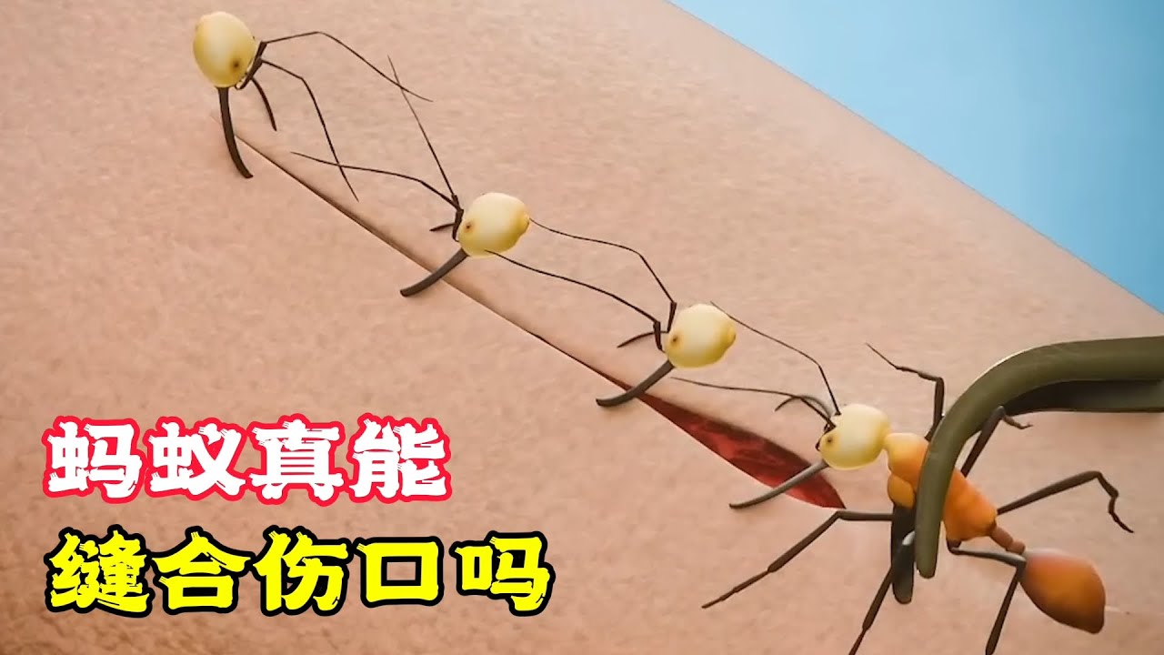 神奇的小螞蟻，竟能縫合傷口，還被稱為自然急救包！科普動畫《螞蟻縫傷口》。電影，短片，成精，解說，搞笑，動畫，動作，喜劇，獵奇，奇幻，腦洞，科幻，超能力，short film