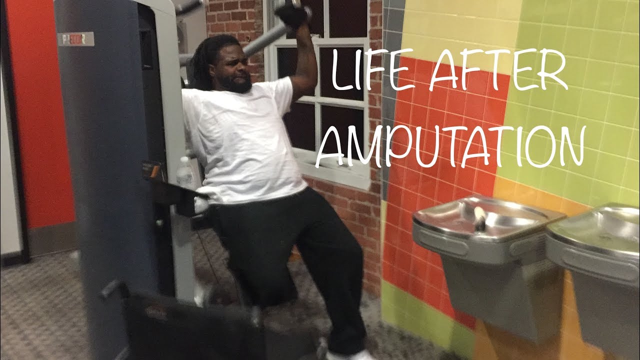 Storytime: My husband had his right leg AMPUTATED!!