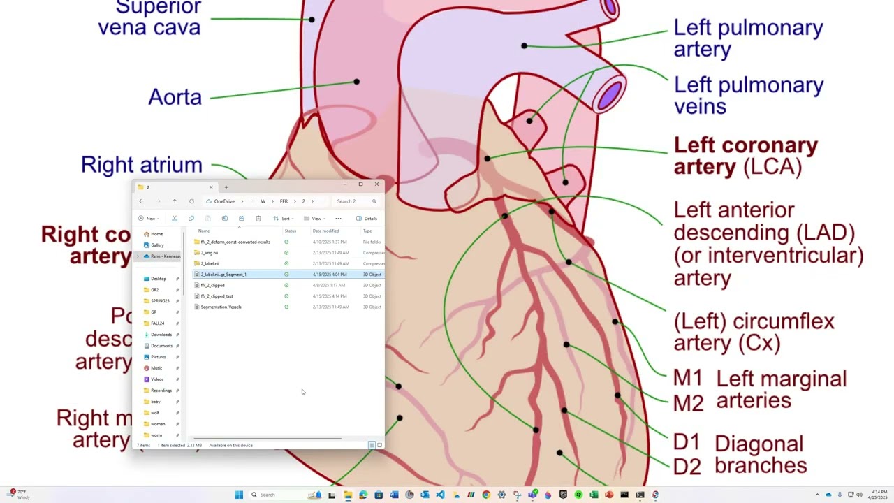 SimVascular  How to perform Deformable Constant Simulations