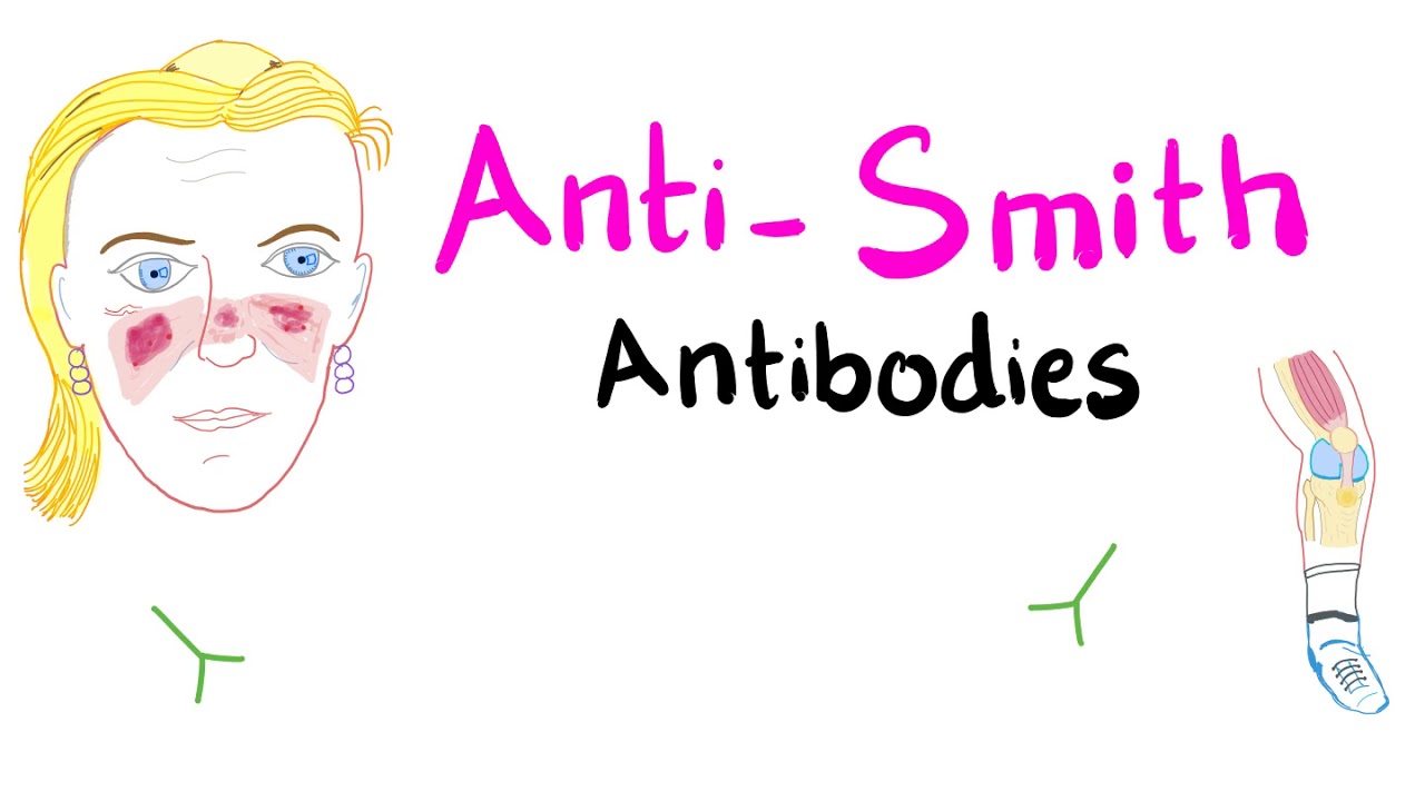 Anti-Smith (anti-Sm) Antibodies; Systemic Lupus Erythematosus