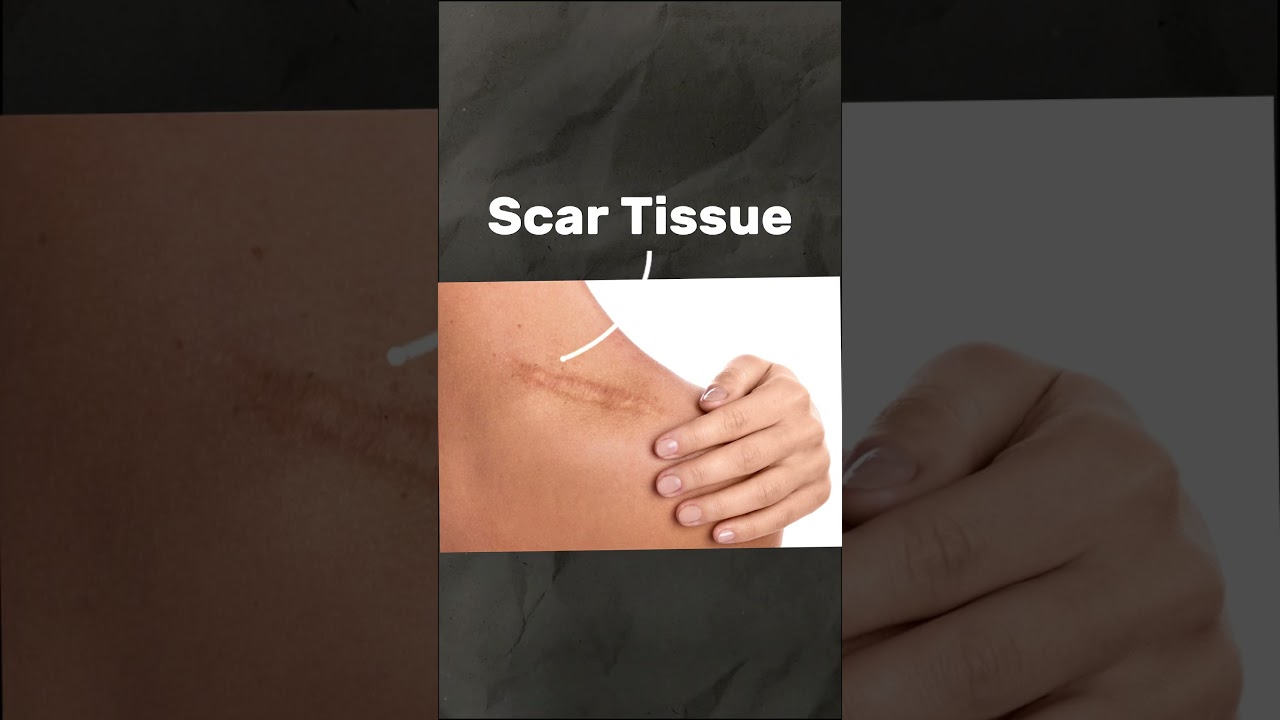 MPS Therapy Explained: Using Microcurrent for Muscle Relaxation & Scar Tissue Treatment