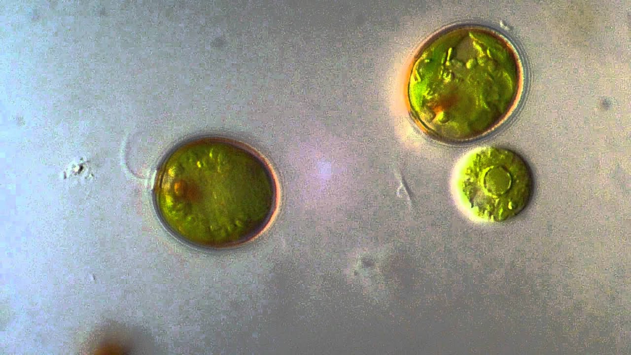 Trachelomonas oblonga - Euglenoid