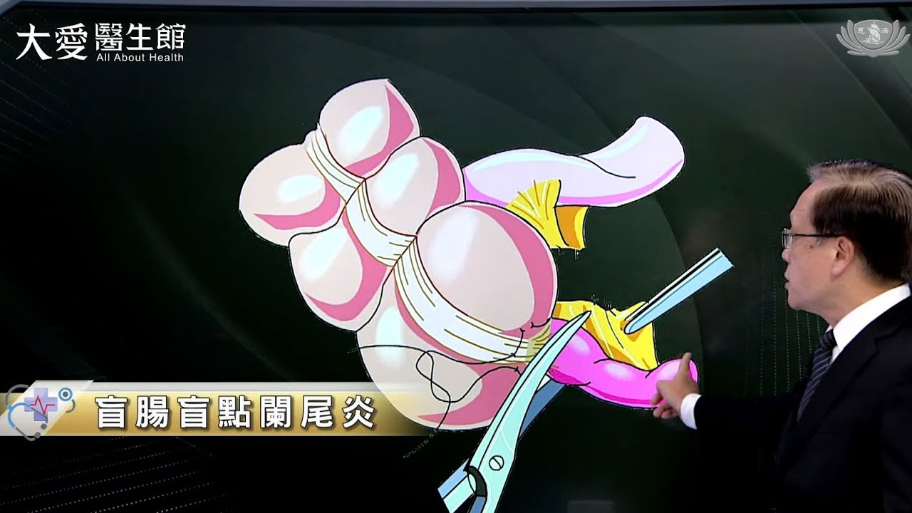 【大愛醫生館】盲腸盲點闌尾炎 20221216