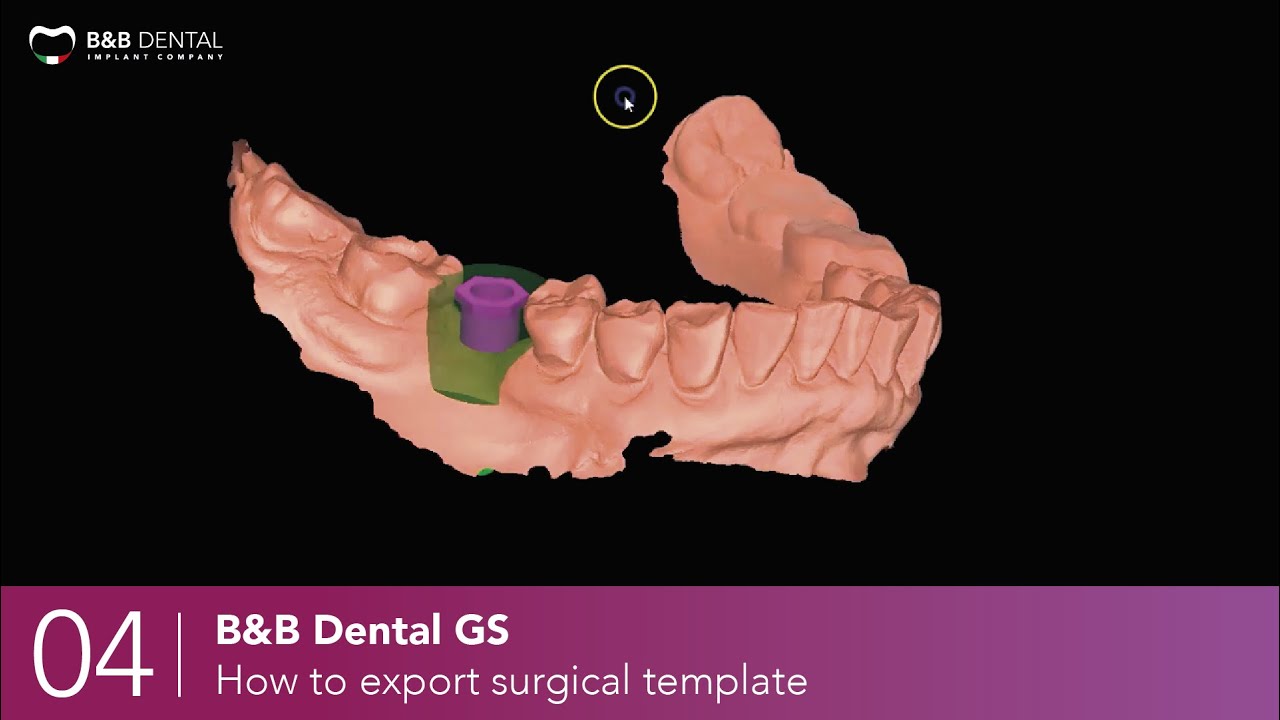 B&B Dental GS - 04 - How to export surgical template