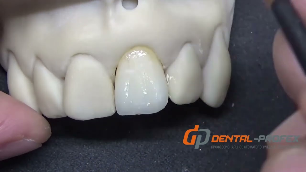Aidite Biomic Stain&Glaze Aesthetic Basic Kit схема многоэтапного окрашивания красками и глазурью