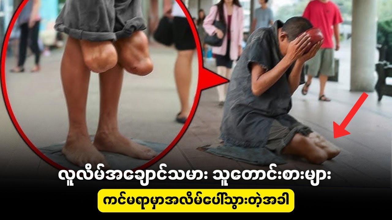 လူလိမ် အချောင်သမား သူတောင်းစားများ ကင်မရာရှေ့မှာ အလိမ်ပေါ်သွားသော အခါ