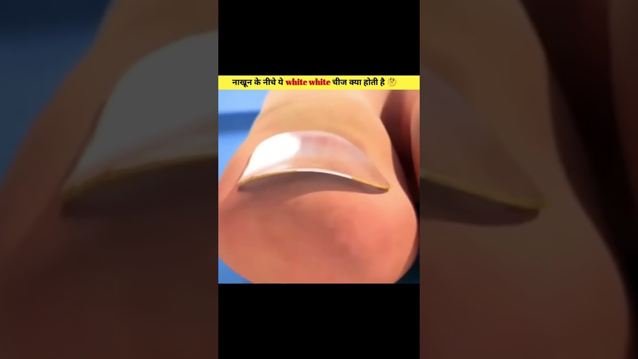 Nakhun Ke Neeche White White Kya Hota Hai? 😳 | Nail Facts | Doctor Bhai
