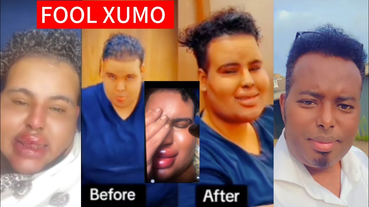 FOOL XUMO WAAN GARIIRE OO FARUURYAHA DURTAY MAXKAMADA DAHIR ALASOW 