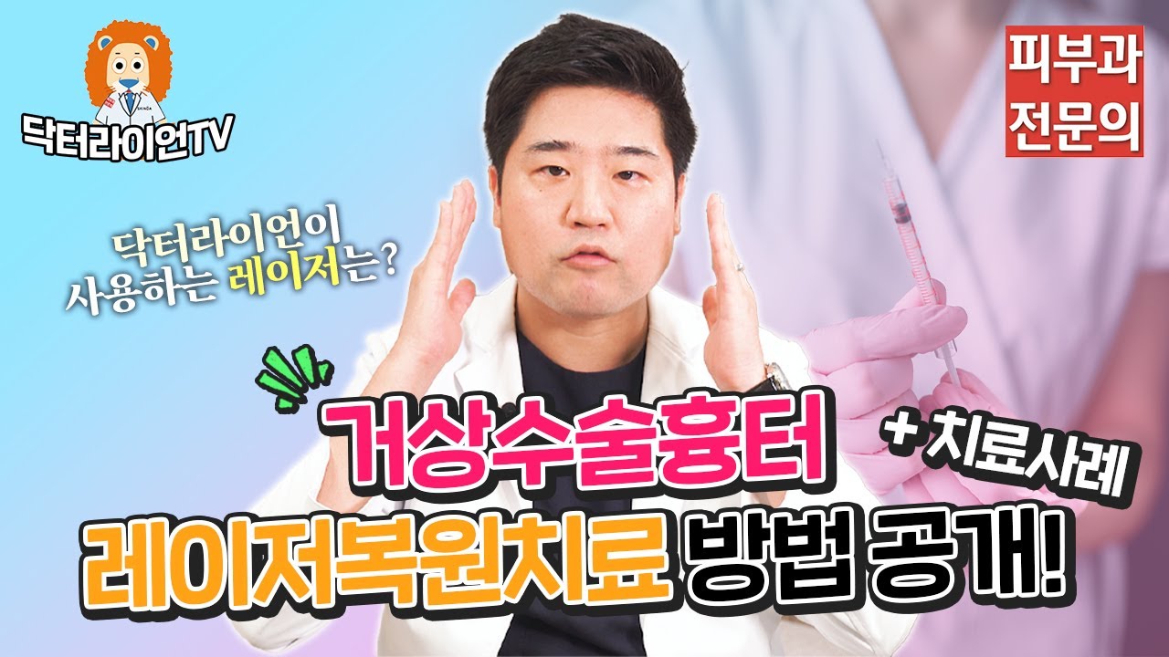 안면거상흉터 / 미니거상 / 이마거상수술흉터 / 레이저복원치료 사례 👀 - 피부과전문의 닥터라이언