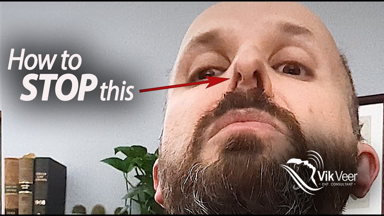 New Nasal Dilator Review - a way to avoid surgery!