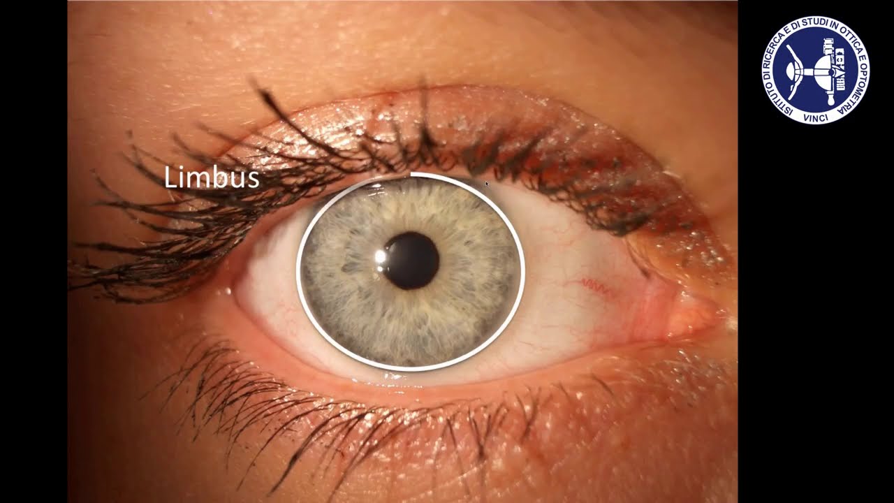 Anatomia della cornea