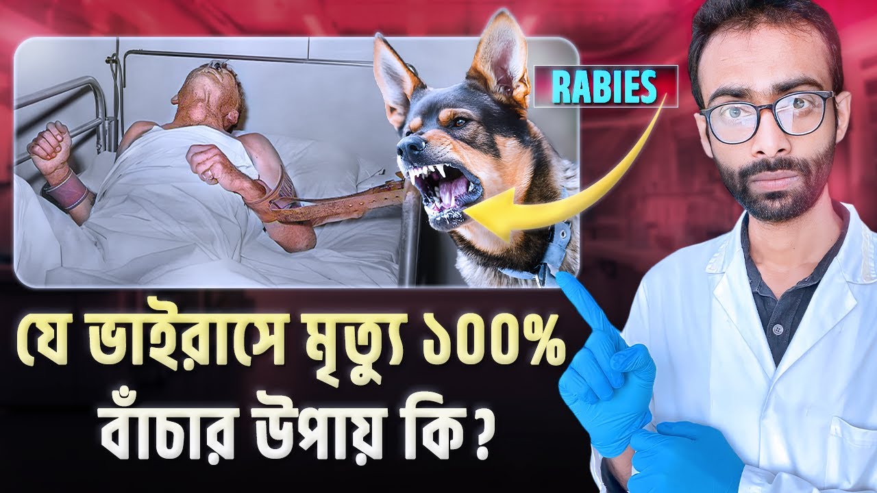 Rabies ভাইরাস শরীরে ঢুকলে কি ঘটে? নিশ্চিত মৃত্যু থেকে বাঁচার উপায় কি? Sabbir Ahmed