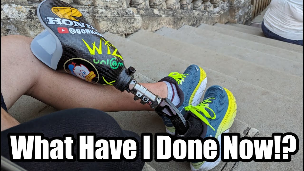What Have I Done Now?! #amputee #prostheticleg