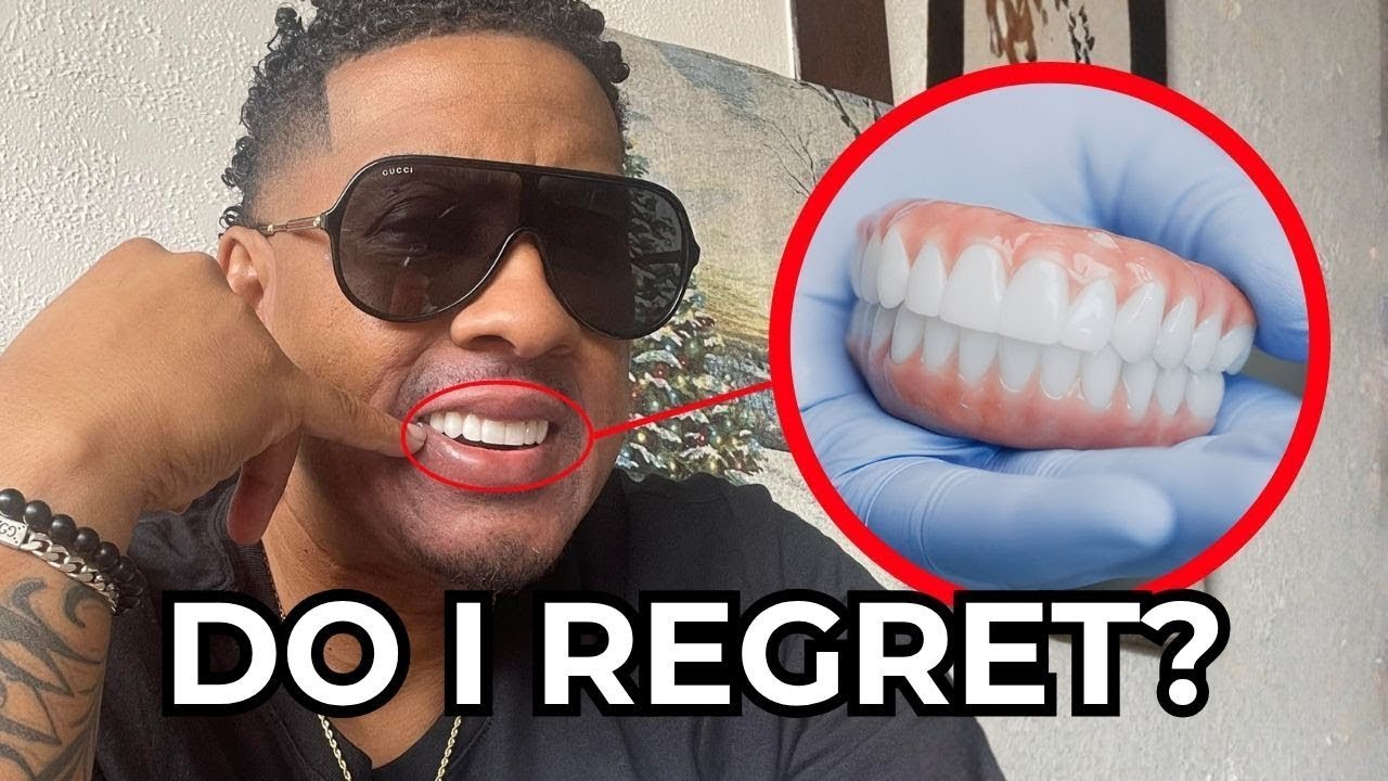 Do I Regret My Dental Implants? (1 Year Later - Honest Review)