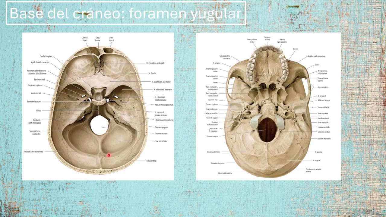 Anatomía Humana 2  Vídeo 3  Práctica 1  Temporal  Porción timpánica