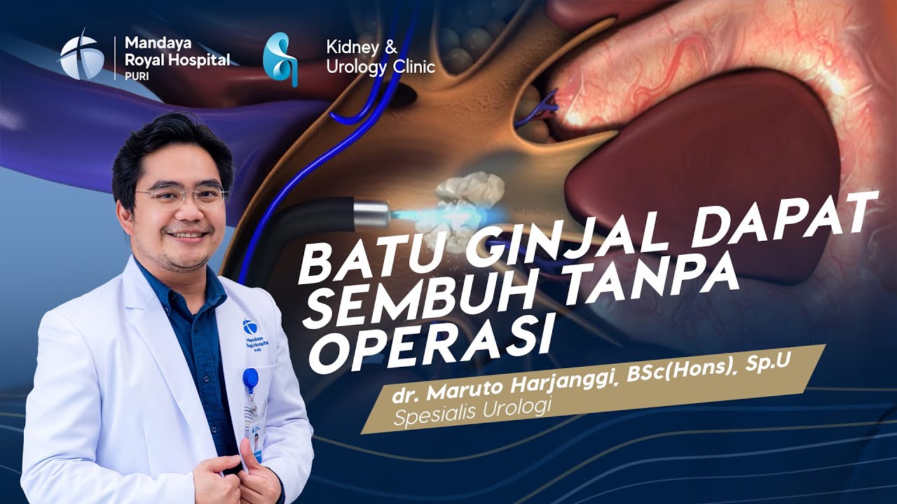 Batu Ginjal Dapat Sembuh Tanpa Operasi - dr. Maruto Harjanggi, BSc(Hons), Sp.U