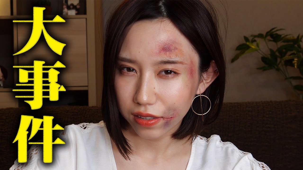 事件に巻き込まれて顔が傷だらけになってしまいました。【ドッキリ】