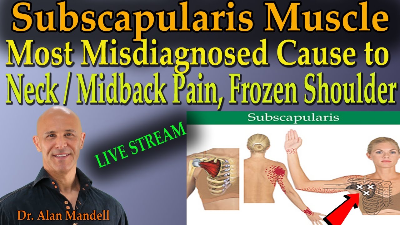 Subscapularis Muscle - Most Misdiagnosed Cause to Neck/Midback Pain & Frozen Shoulder (Dr Mandell)