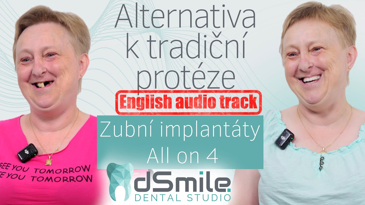 All-on-4: Náhrada zubů ve 45 letech – Konec s protézou!#implant#dentist #dsmile#allon4dentalimplants