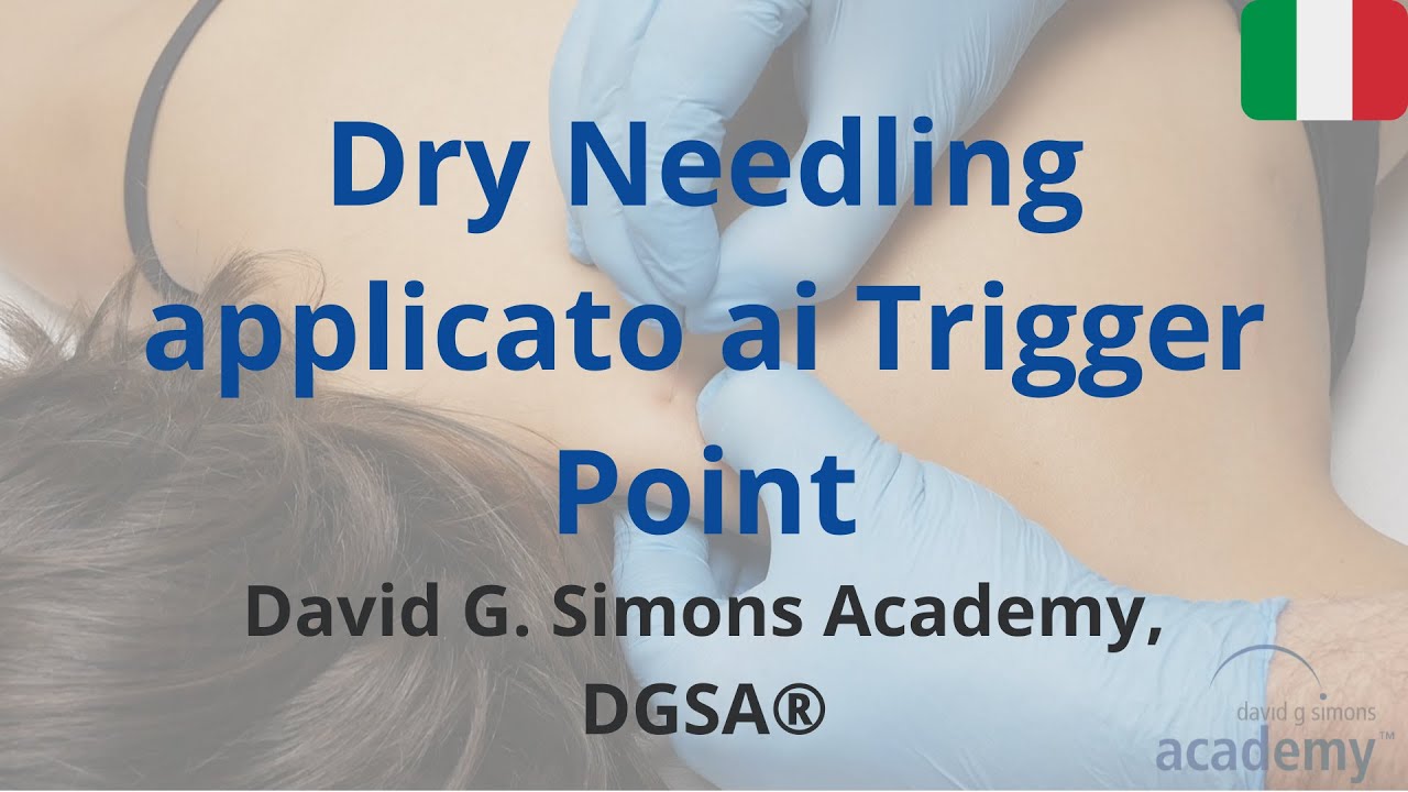 Dry Needling applicato ai Trigger Point