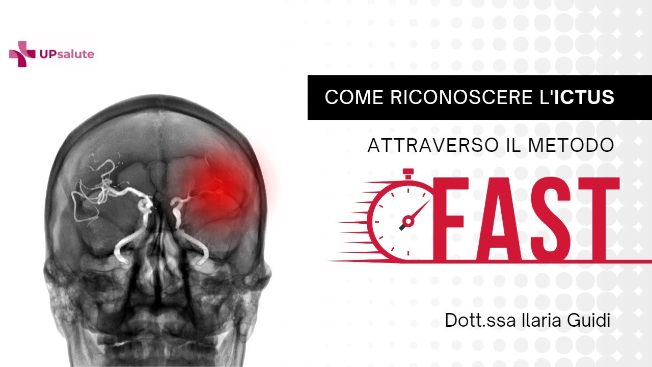 Riconoscere l'ictus attraverso il metodo FAST - Dottoressa Ilaria Guidi - UPsalute Channel