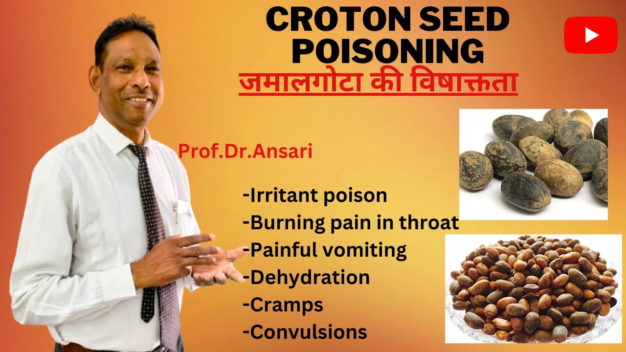 Croton seed poisoning | Irritant poison |Painful vomiting |Dehydration | Toxicology |Prof.Dr.Ansari