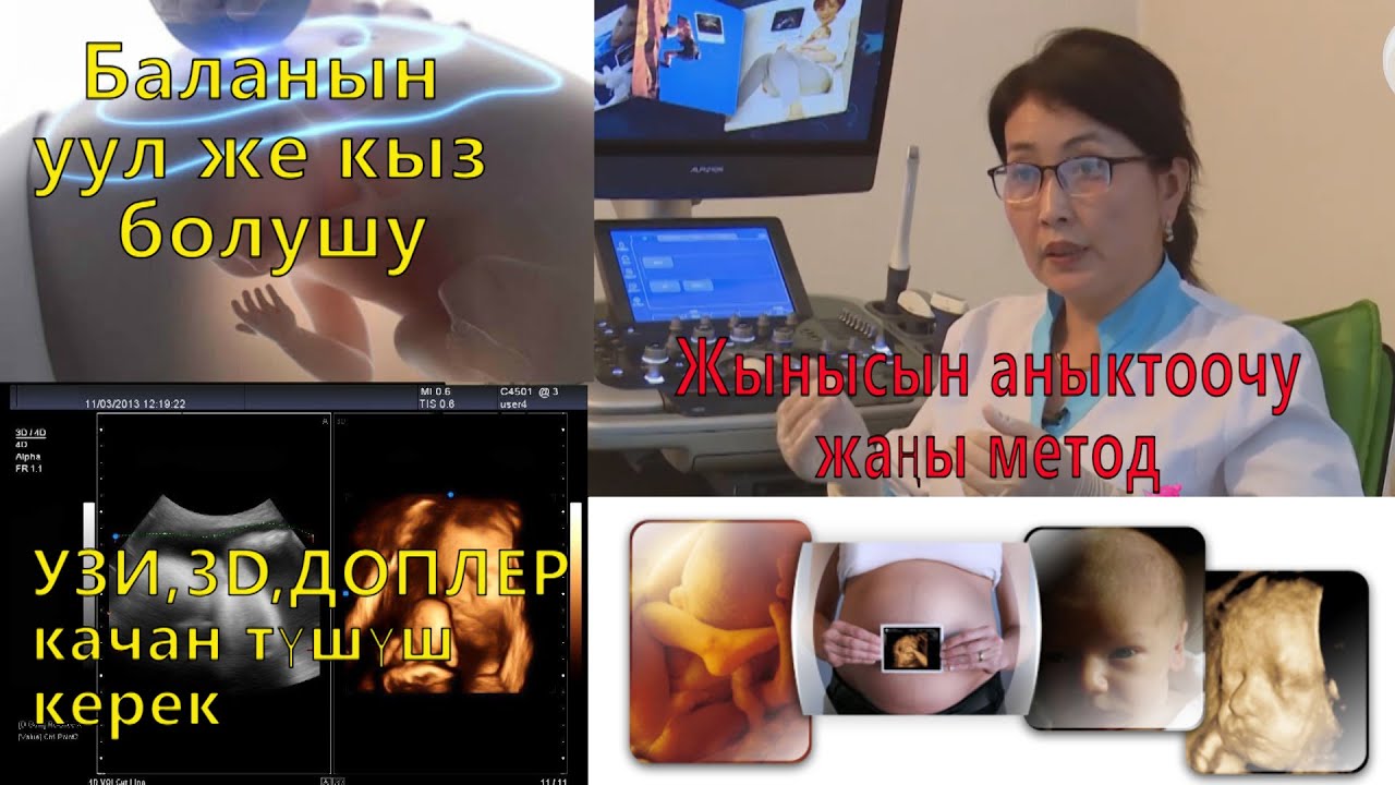 УЗИ, 3D, ДОПЛЕРге качан түшүш керек? Баланын жынысын аныктоочу жаңы метод!