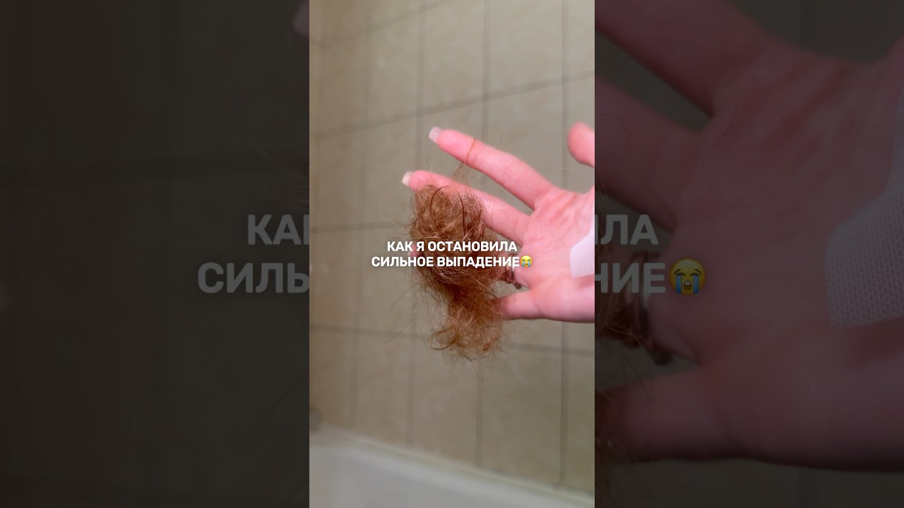 КАК Я ОСТАНОВИЛА СИЛЬНОЕ ВЫПАДЕНИЕ ВОЛОС