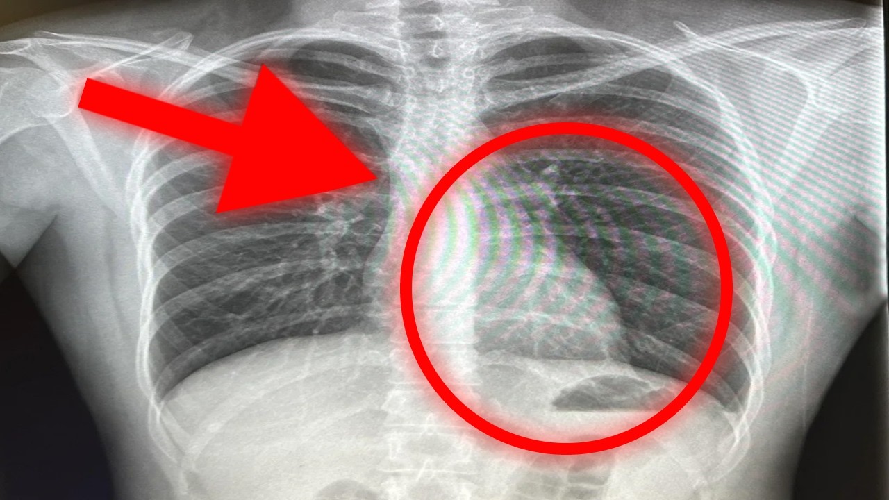This is what happens when you eat something you are Allergic to