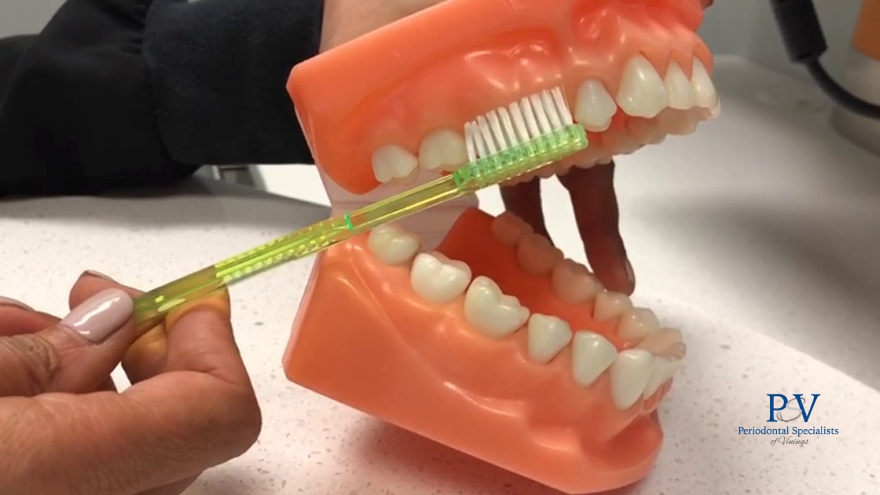 How To Brush Your Teeth 4 Weeks After Gum Graft Treatment - Periodontal Specialists of Vinings