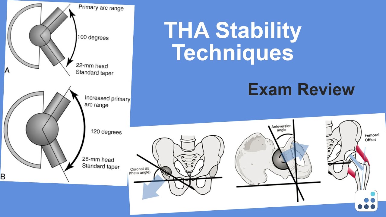THA Stability Techniques Exam Review - William Griffin, MD
