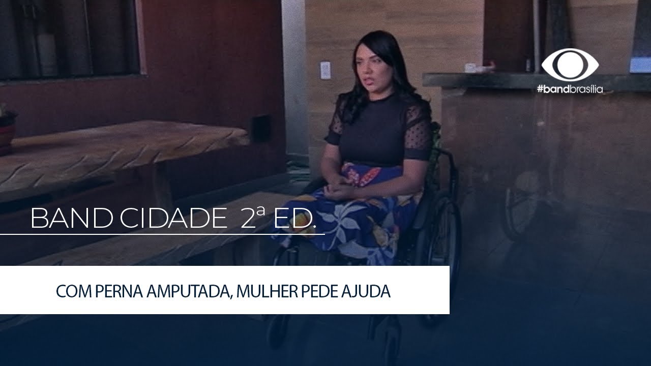 COM PERNA AMPUTADA, MULHER PEDE AJUDA PARA VOLTAR A TRABALHAR | Band Brasília 01/07/2022