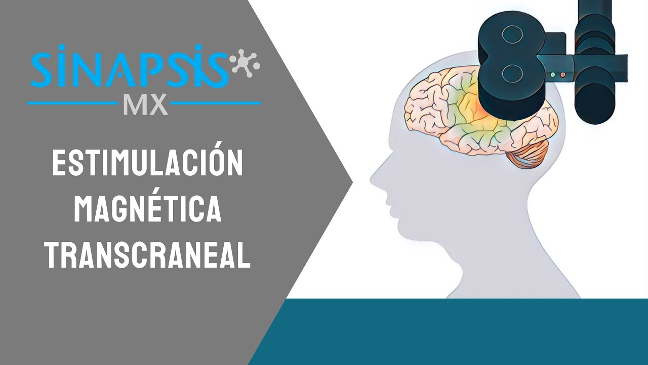 Estimulación magnética transcraneal, todo lo que necesitas saber.
