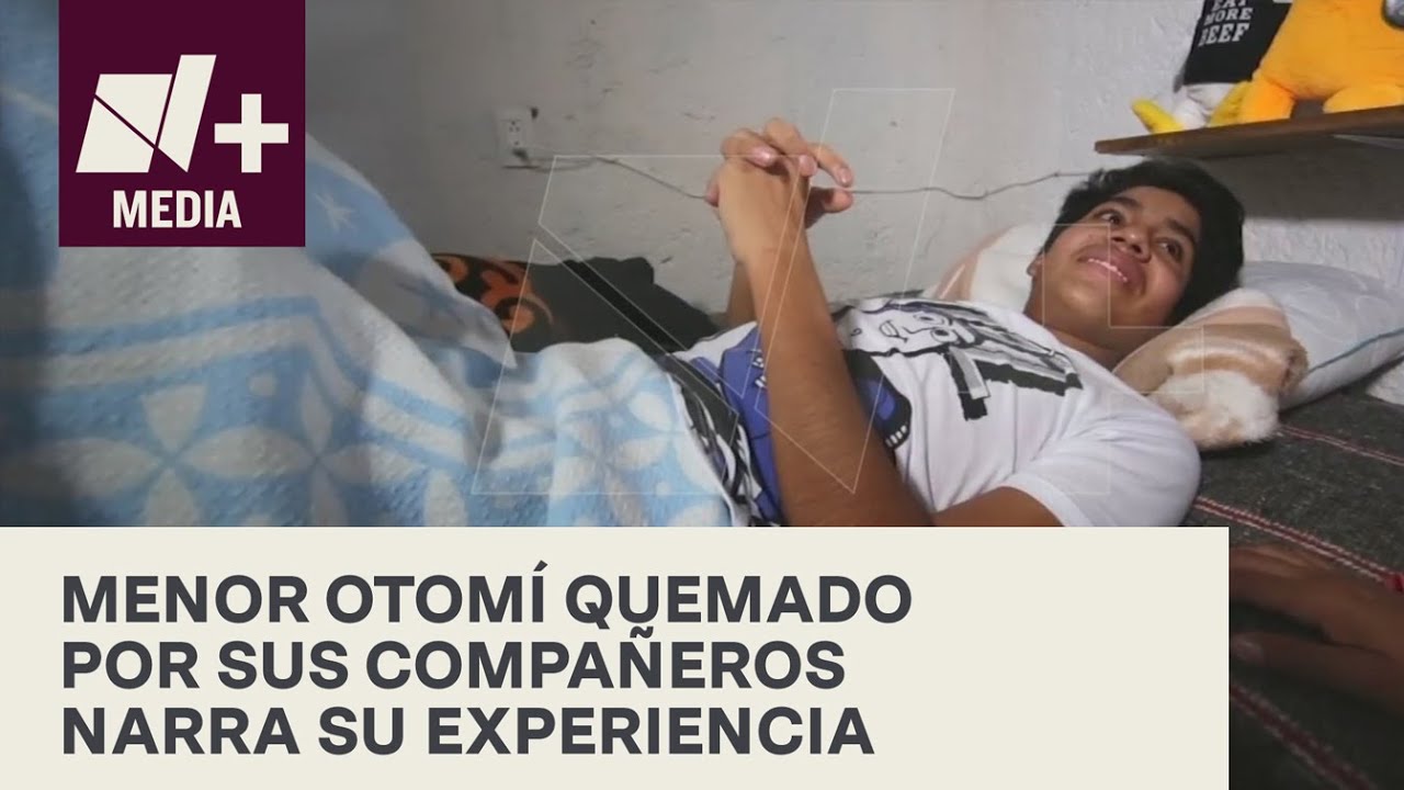 Niño Otomí quemado en telesecundaria cuenta su experiencia - N+ 15