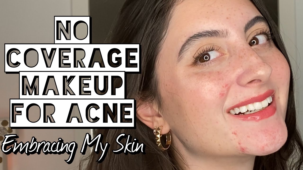 NO COVERAGE Makeup For Acne | Embracing My Skin w/ this Summer Makeup Routine to Enhance Features