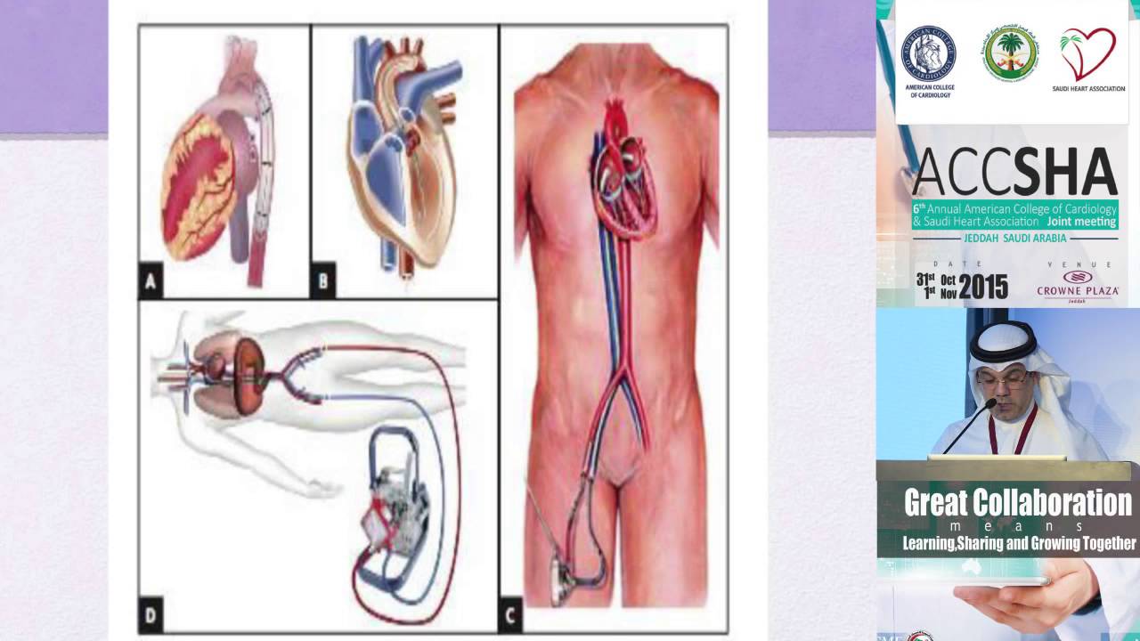 Mohammed Kurdi Cardiogenic Shock Interventional Strategies