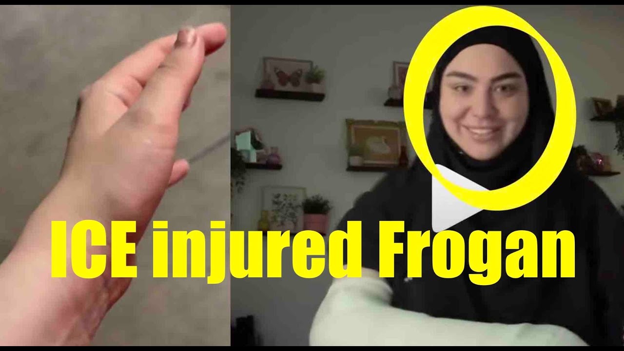 ICE Injured Frogan Hand | Ethan Klein vs Frogan Lawsuit Explained