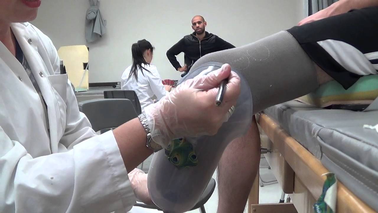 Adéquation emboîture d'essai trans-tibial