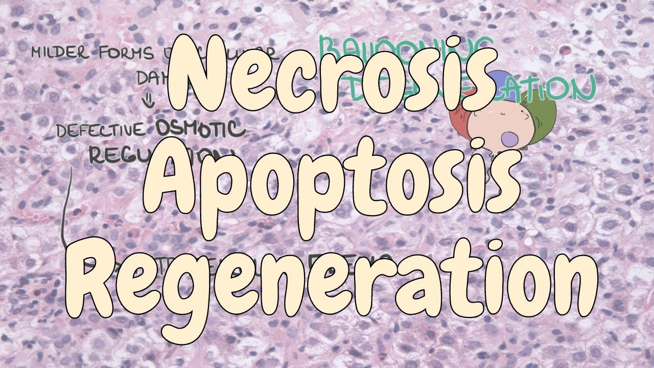 Necrosis, apoptosis and regeneration - liver pathology