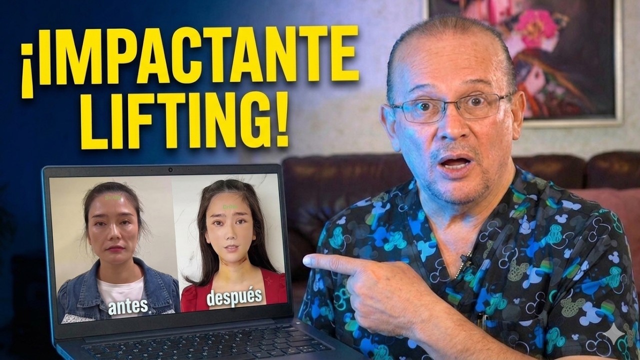 Ranking de las polémicas cirugías plásticas del Dr KIM