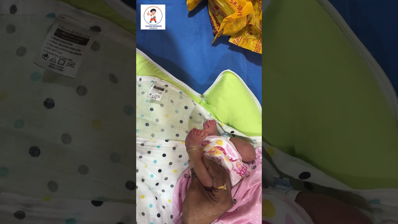 How To Do Stretching Exercises For Positional CTEV in a Newborn