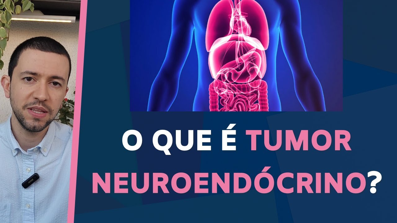 O que é TUMOR NEUROENDÓCRINO??